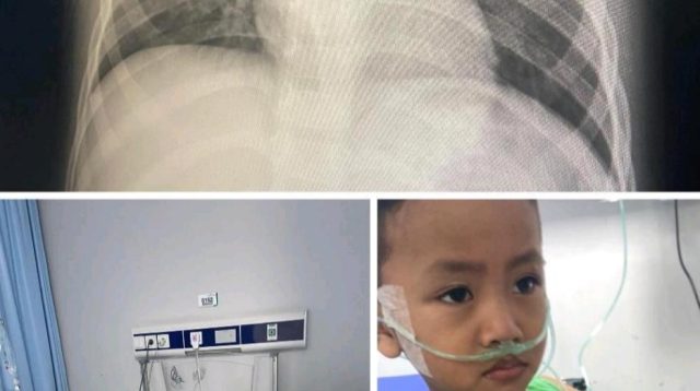 Asap Pembakaran Sampah Ganggu Kesehatan, Warga Jakarta Barat Minta Penegakan Aturan